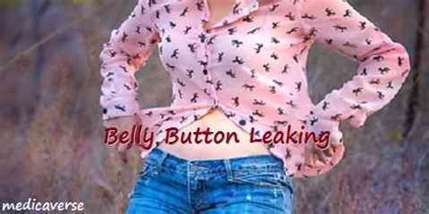 belly button is leaking|Belly Button Discharge: Causes, Treatments, and More